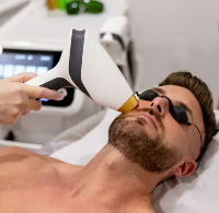 Epilation électrolyse définitif pour épiler le visage pour barbe homme près de Lyon 4 Croix-Rousse