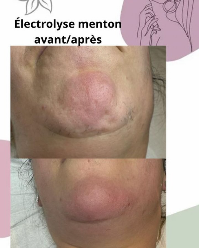 Massage manuel Renata pour relaxation profonde et soulagement musculaire près de Villeurbanne 69100