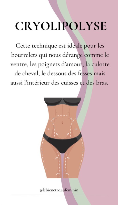cryolipolyse 