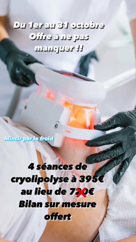 offre minceur cryolipolyse 
