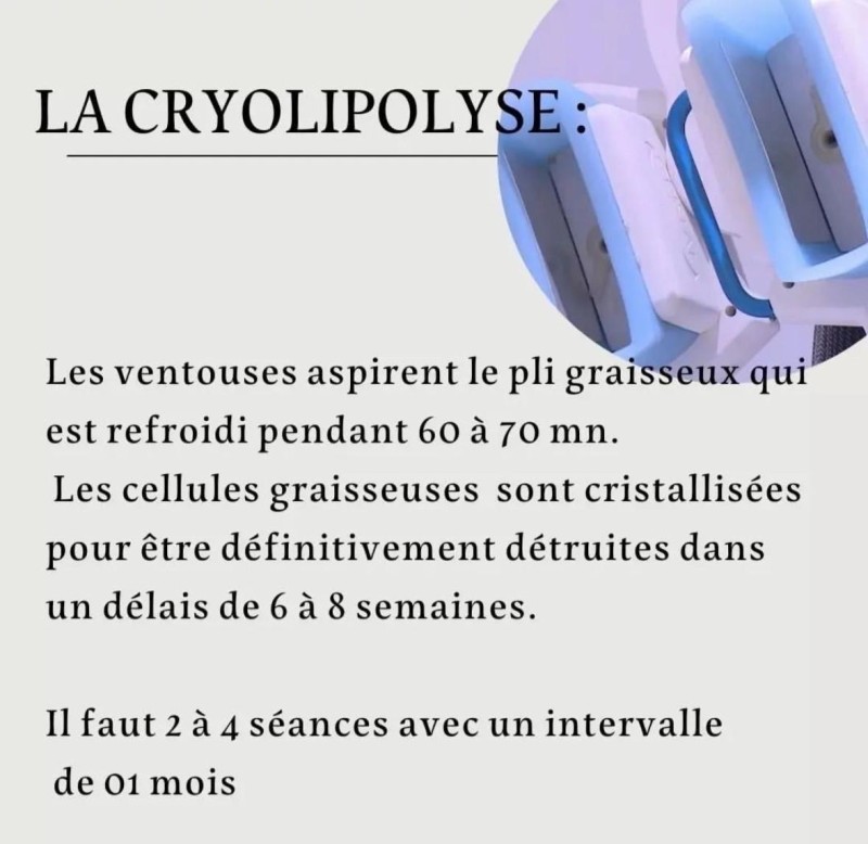 offre minceur cryolipolyse 