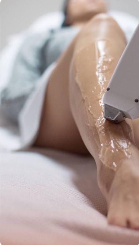 Avant/ après laser définitif en douceur sur les jambes fait institut à Lyon 6 proche Brotteaux  - 30 minutes par séance