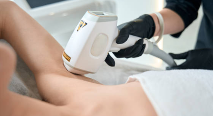 Épilation définitive au laser de toutes parties du corps pour les femmes et les hommes à Lyon chez Le Bien-être au Féminin