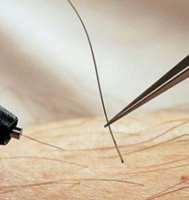 Notre zone d'activité pour ce service Massage manuel Renata pour relaxation profonde et soulagement musculaire