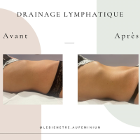 Notre zone d'activité pour ce service Cryolipolyse traitement efficace contre la graisse localisée