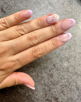 Notre zone d'activité pour ce service Cryolipolyse traitement efficace contre la graisse localisée